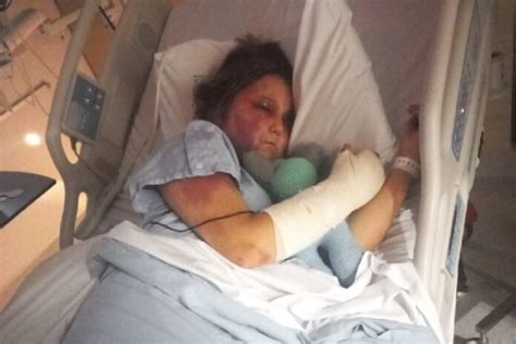 kirra hart news australia|Brutal Attack Against Kirra Hart – The Paw Newspaper